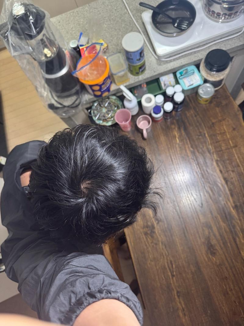 오늘 피부과 가서 탈모 초기라는 진단 받고 약 타왔습니다.