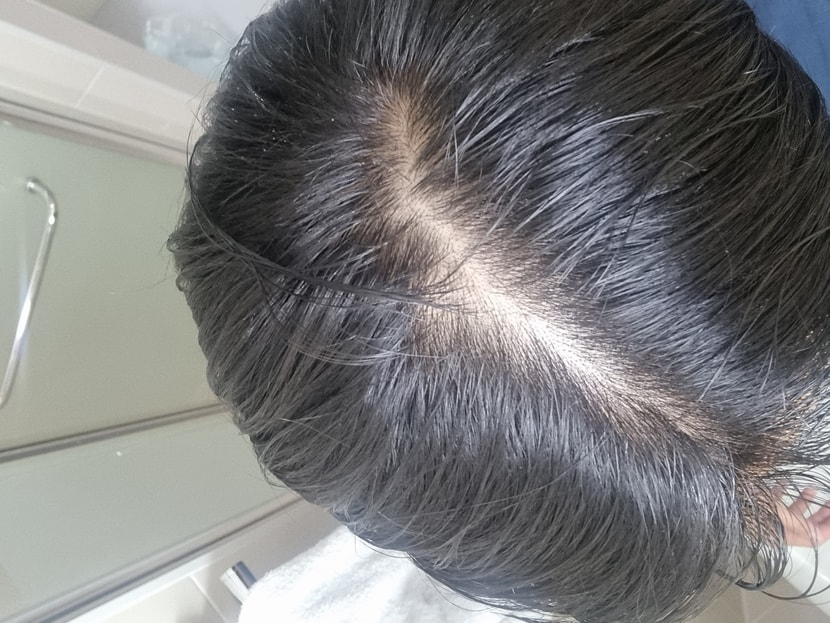 떡진거
