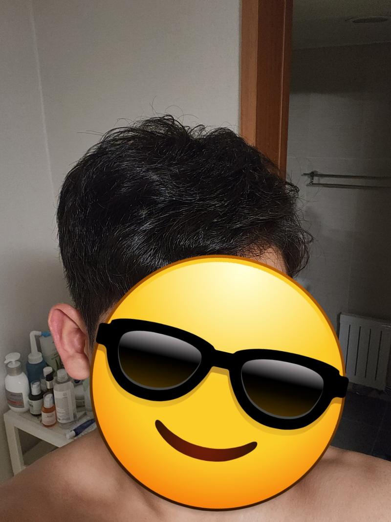 미녹시딜 정 효과 정말 잘 보고있습니다.!! 행복하네요