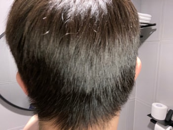 뒷머리 사진(머리 안깠을 때)