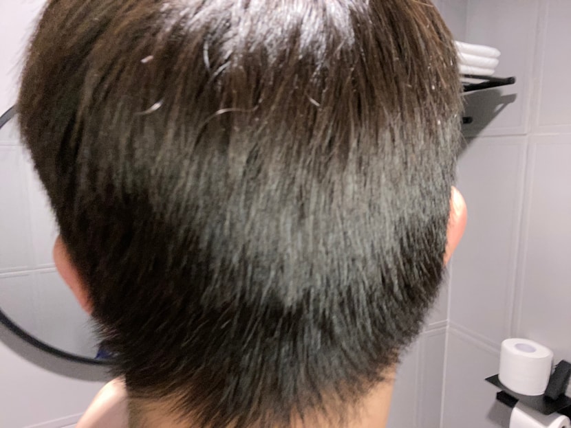 뒷머리 사진(머리 안깠을 때)