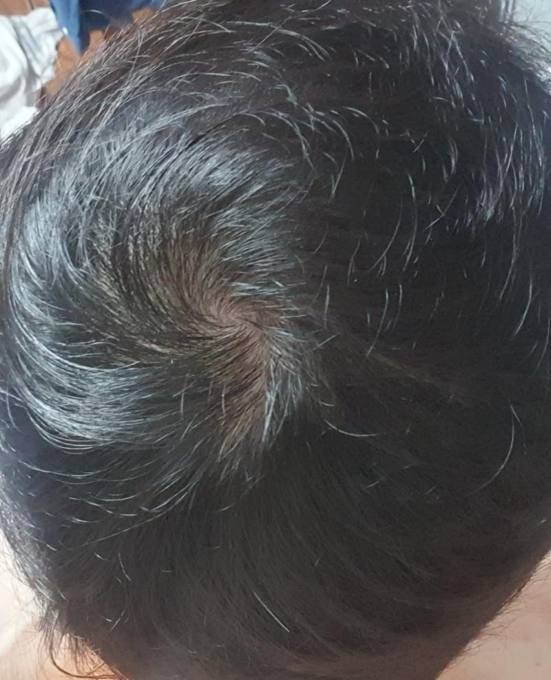 この程度ならもっと生きられるでしょうか？