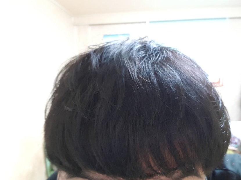 정면샷