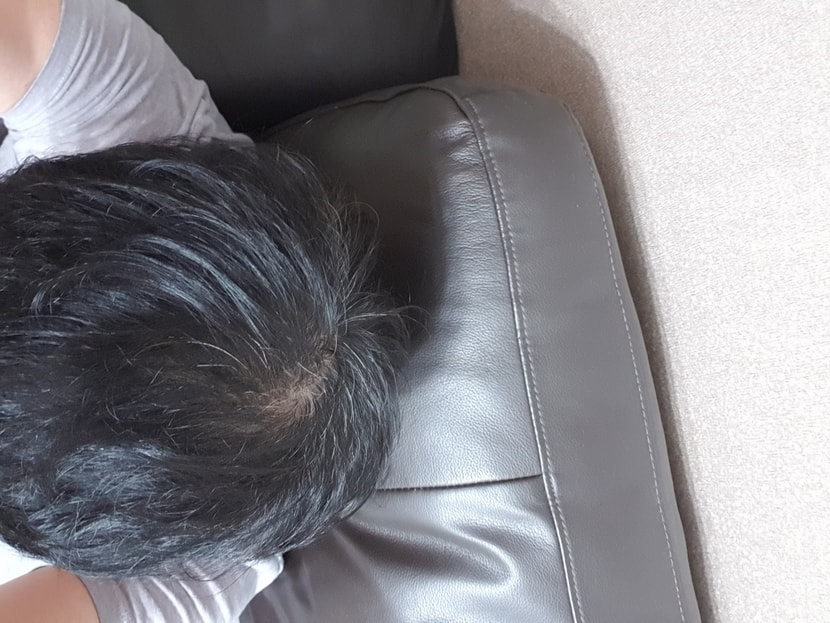 초창기 와 현재