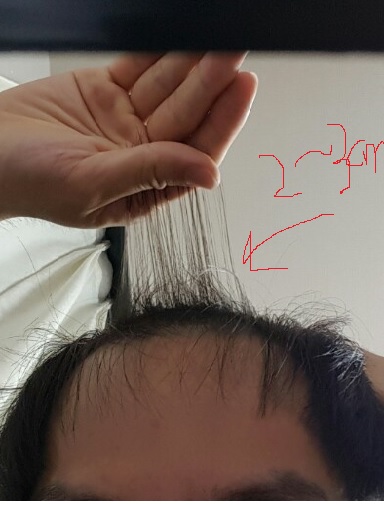 이마 근처 위치