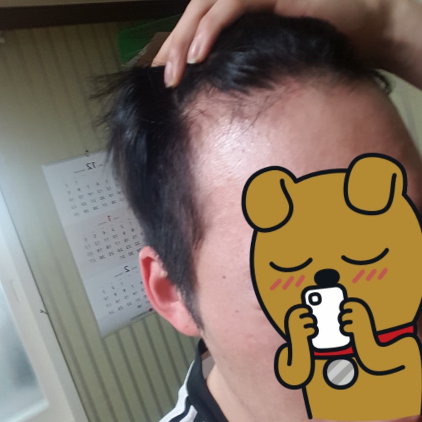 오른쪽 사진