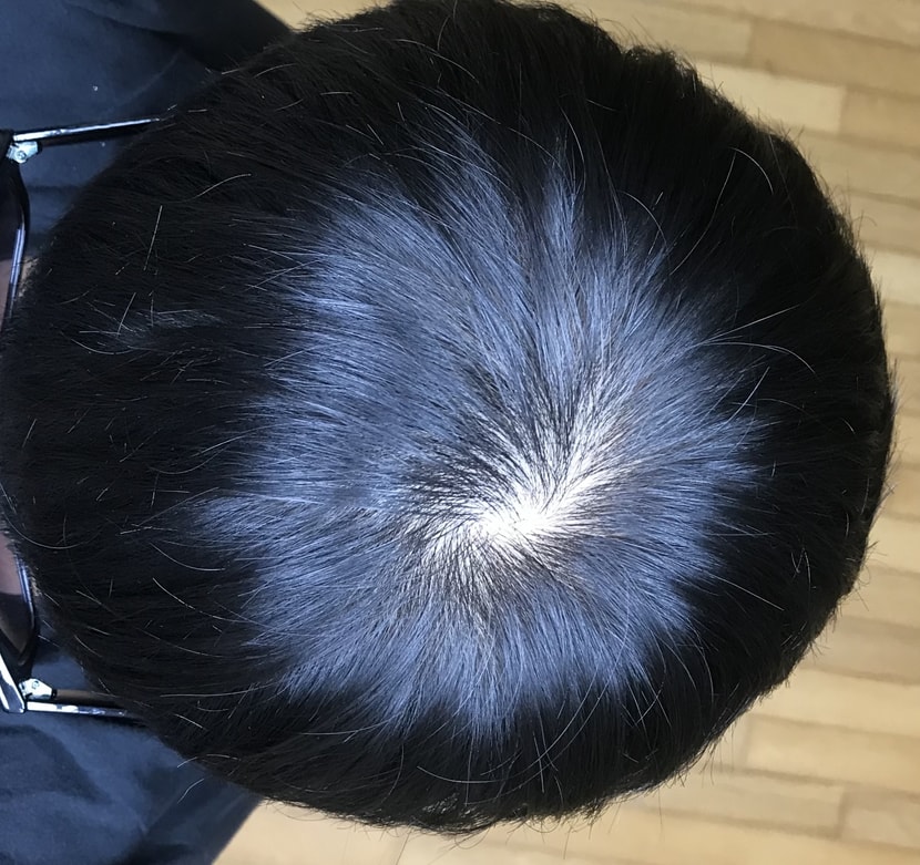다이어트 6개월 지난후