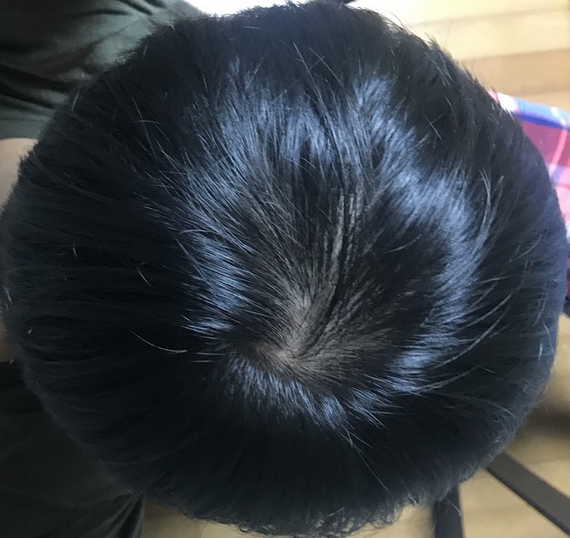 다이어트 1년후