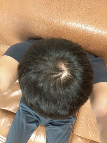 정수리