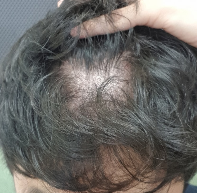 관리기간 막바지 개인 촬영