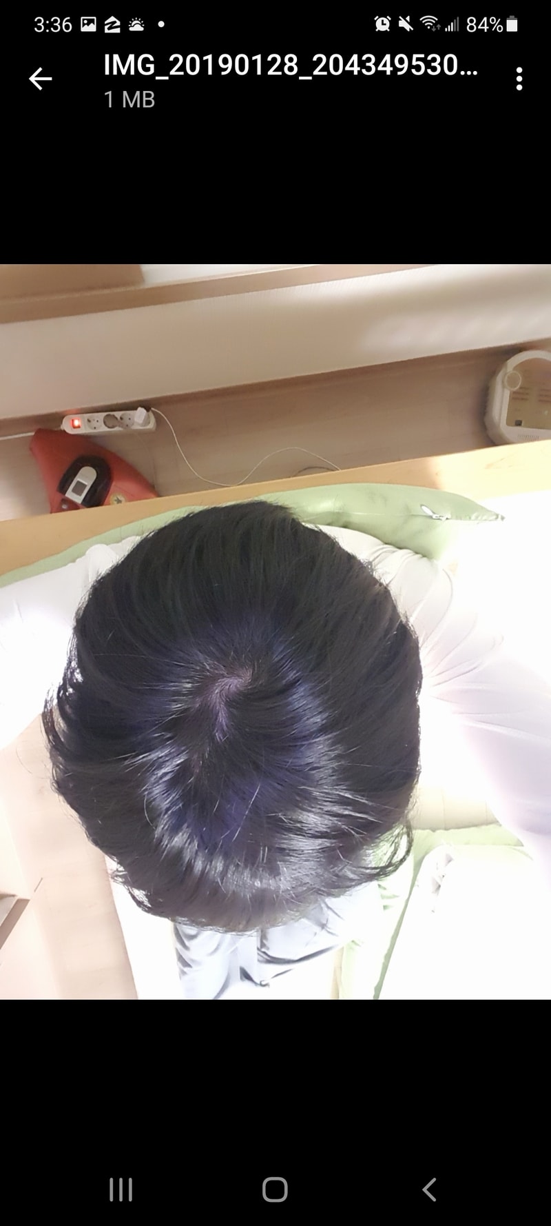 프로페시아 계열 복용 3년 후 아보다트로 바꿔야할지