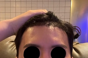 수술후