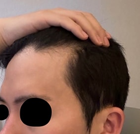 수술전