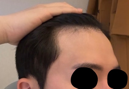 수술전