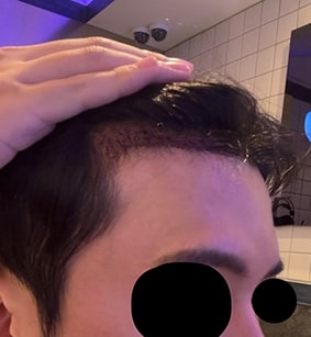 수술후