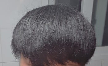 정면