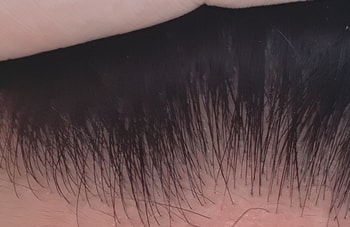 이미 확대