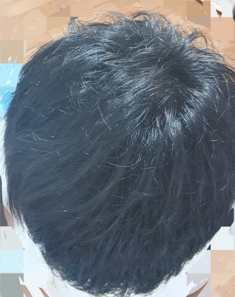 정수리