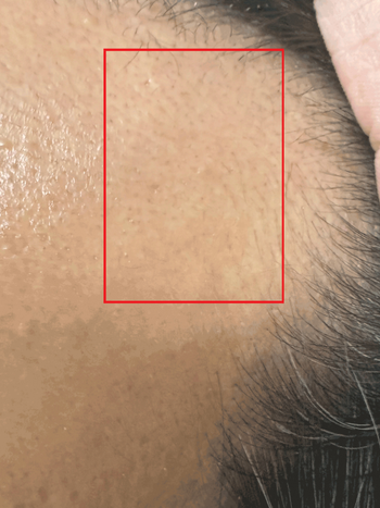 11월19일 / 앞에 잔머리 발견