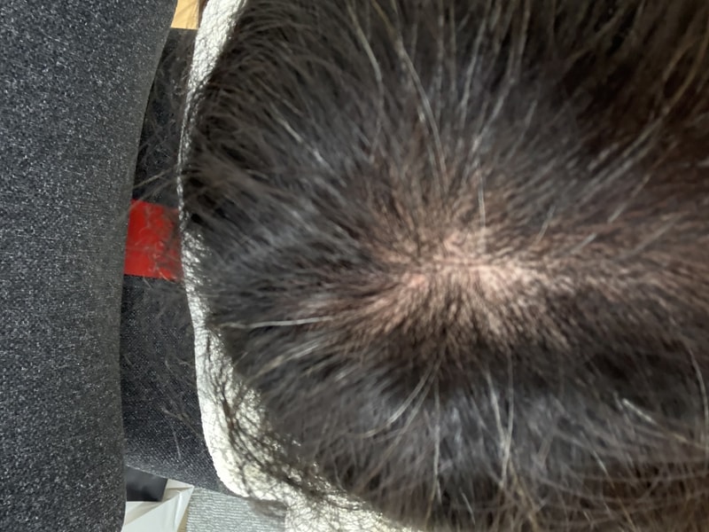 2ddr 토너 후기 (3) - 94일