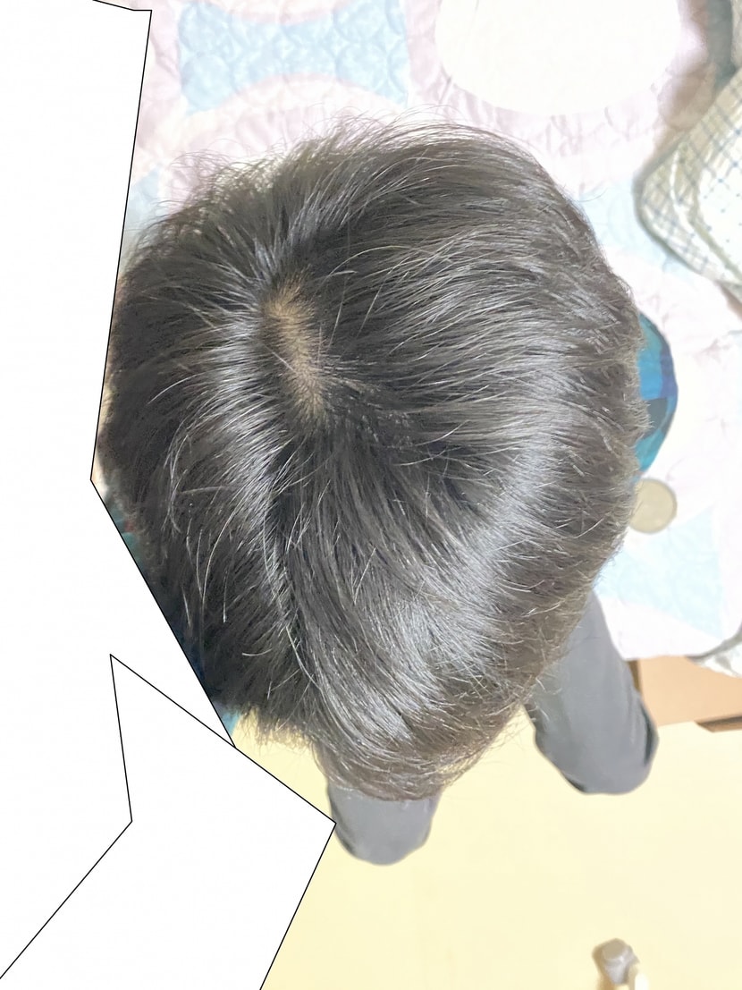 20년 4월 12일 마이페시아 3개월차 복용