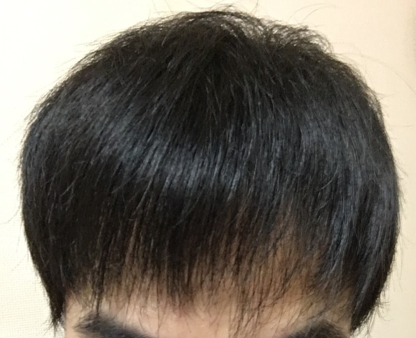 머리내리고