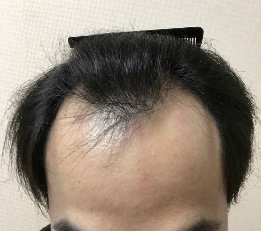 정면샷