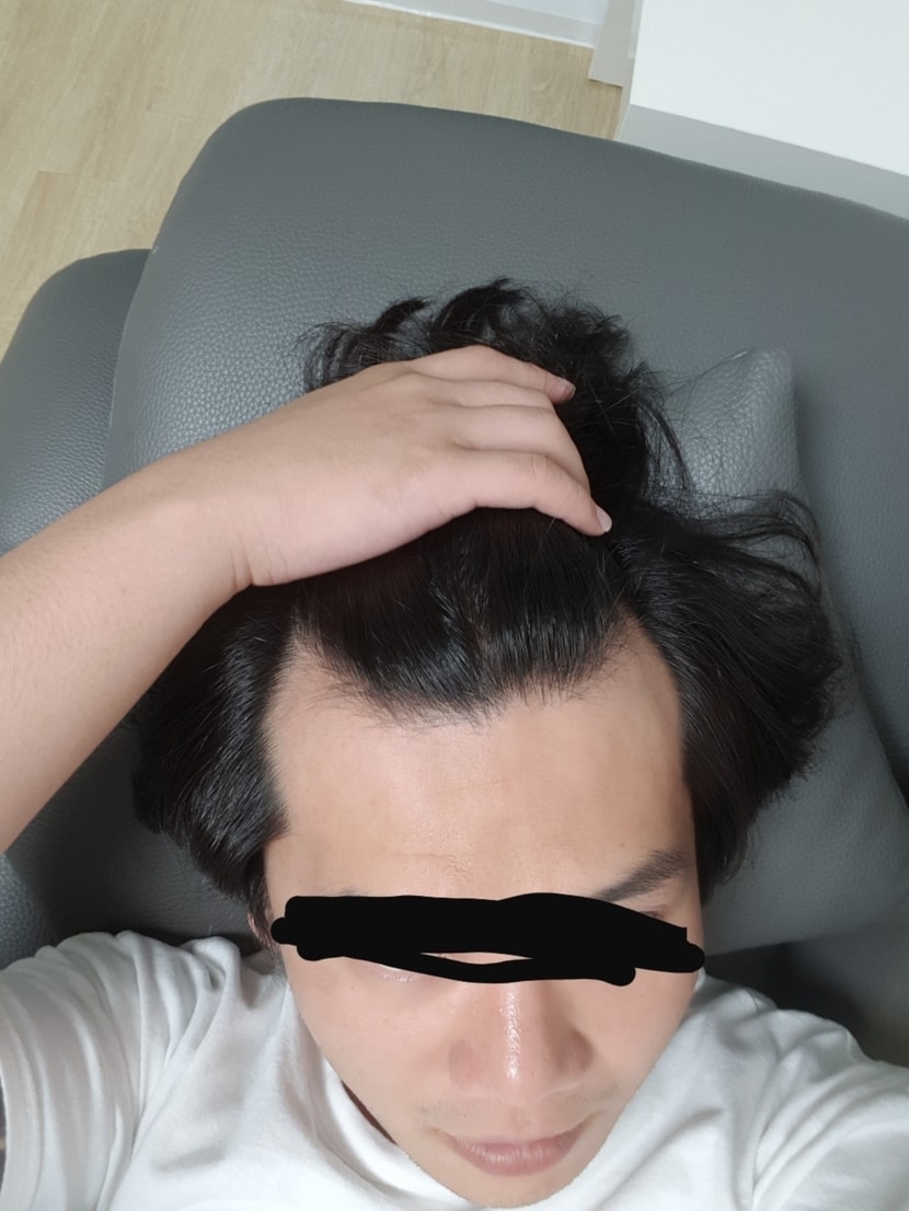 수술전 엠자