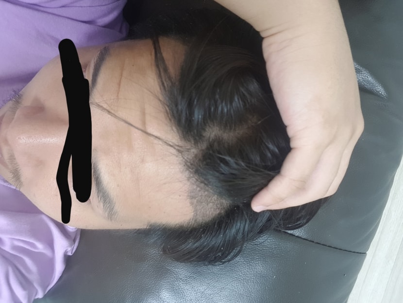 수술후 엠자