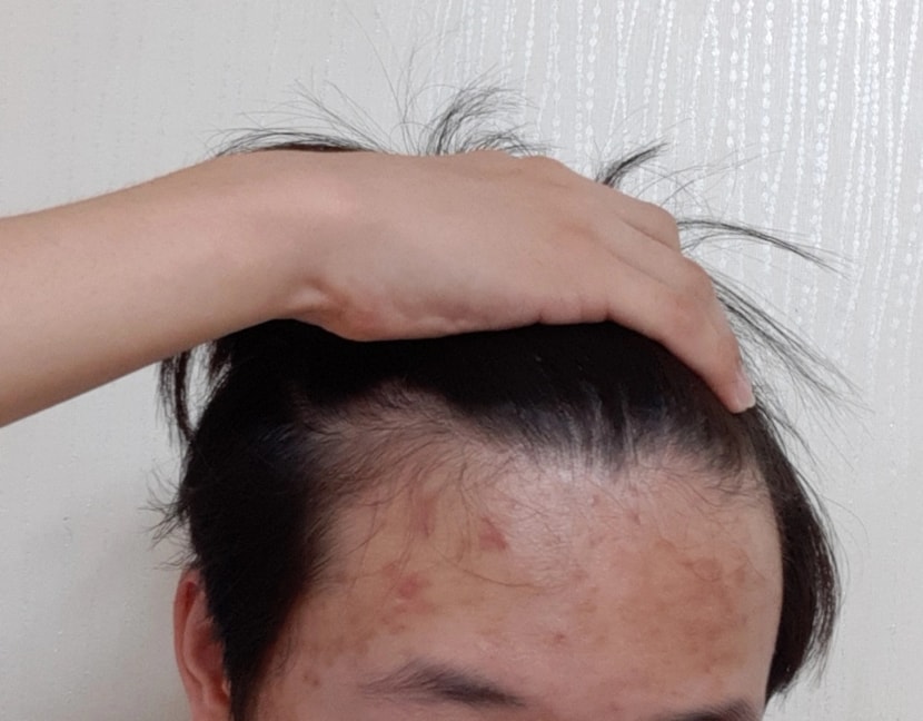 현재 사진