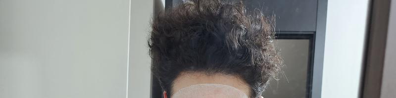 약 3년차 프로페시아