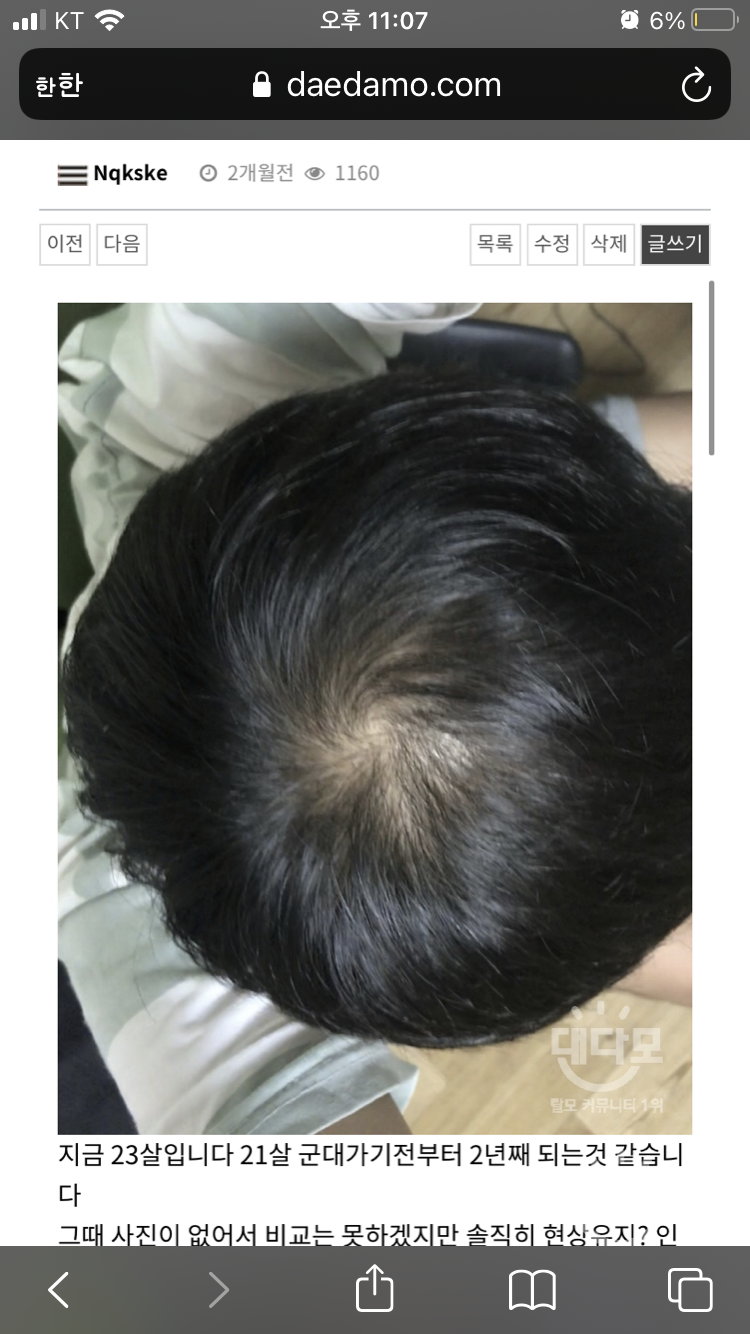 로게인폼 바른지도 꽤 많은 시간이 흘렀습니다