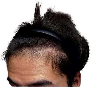 2021