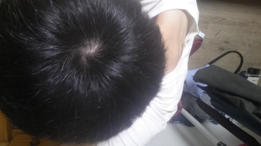 그래서 머리감고 찍었는데 머리감으니 그나마 낫더라구요 ㅎㅎ