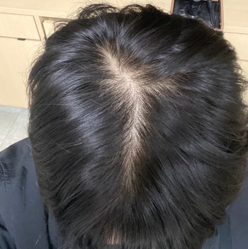 23년 10월 1년 복용후 말이 1년이지 6개월 먹고 거의 안먹음 