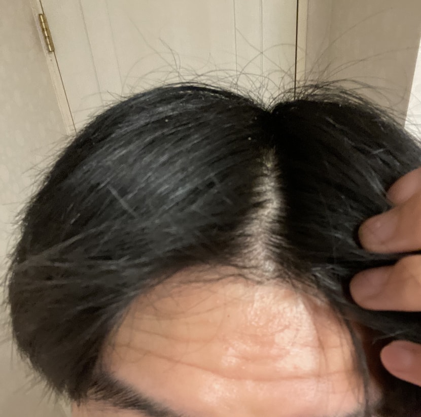 이건 금방 추가한 어제 사진입니다 이부분이 넓어 보여서요