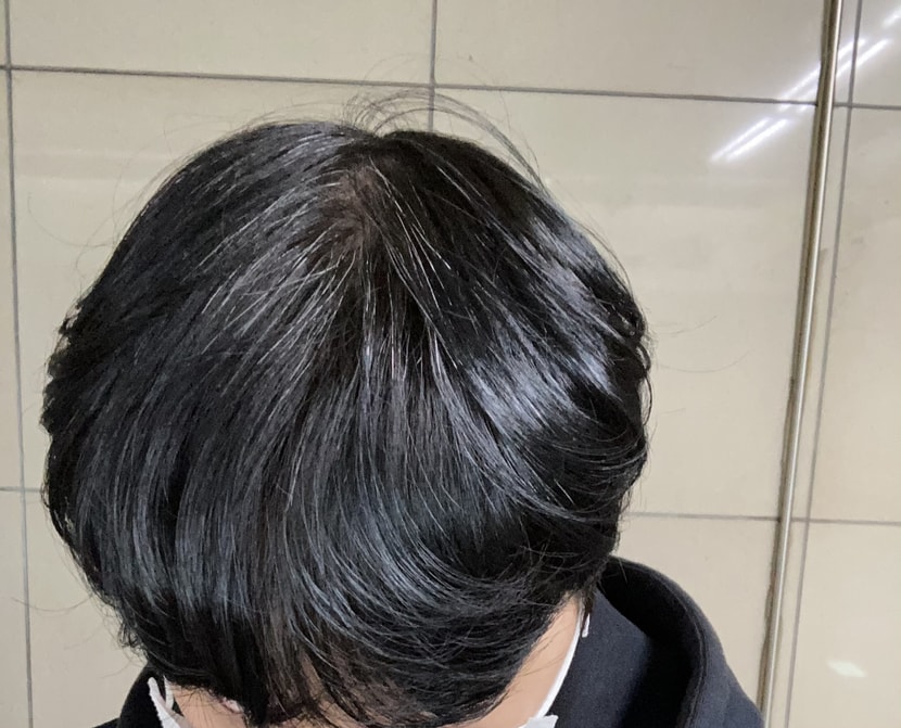 평소머리사진 흰머리가 계속자랍니다..