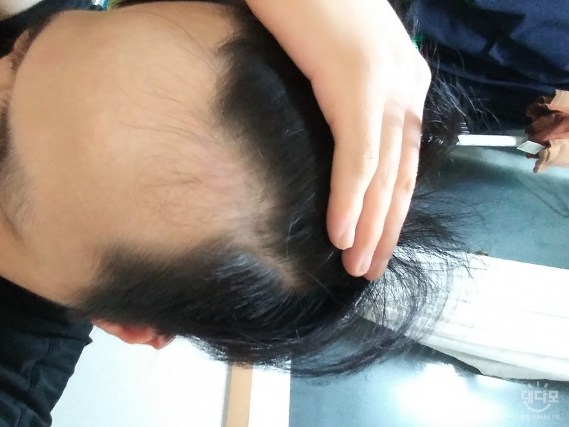 6달전