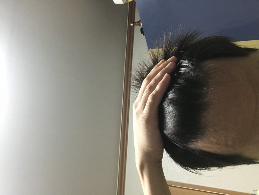 2년전 약 안먹음