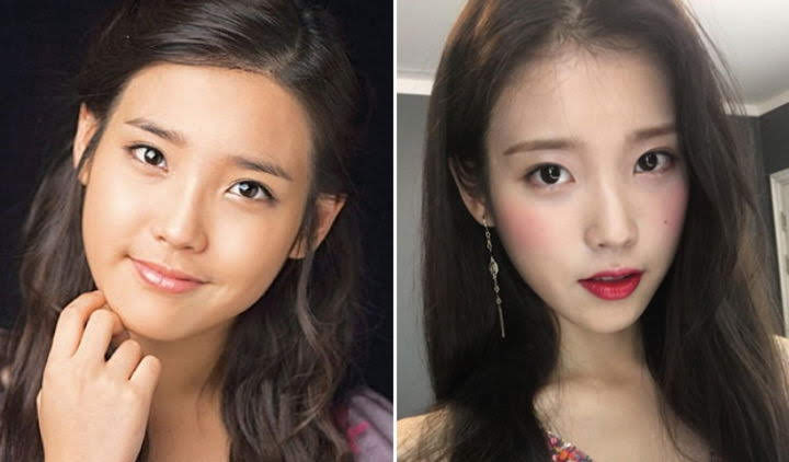 헤어라인