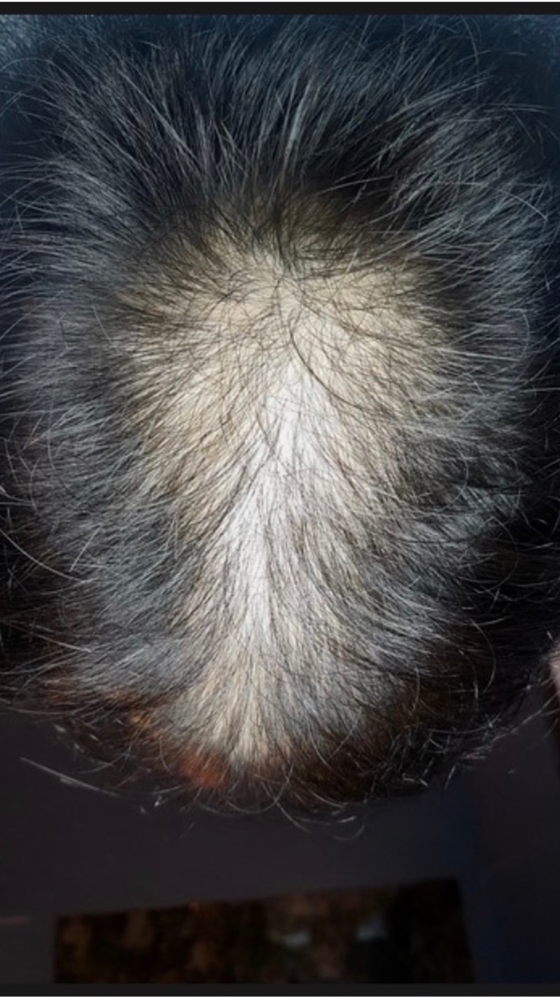 薬+未収録の22ヶ月はいかがですか？