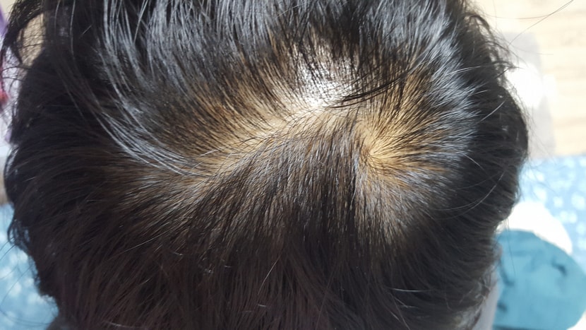 제 상태입니다. 점점 나아진 모습이 되길 바라면서 올려봅니다!