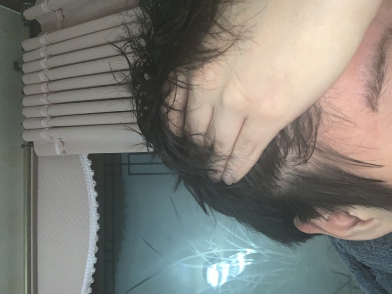 Dupa로 인해 19년에글쓰고 1년 반정도가 지났네요..