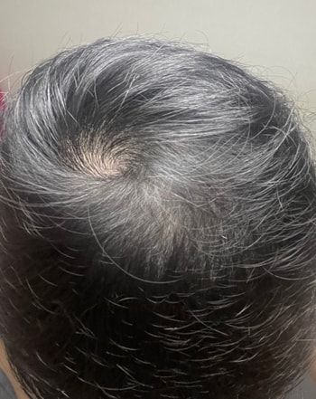 2달하고 일주일 현재