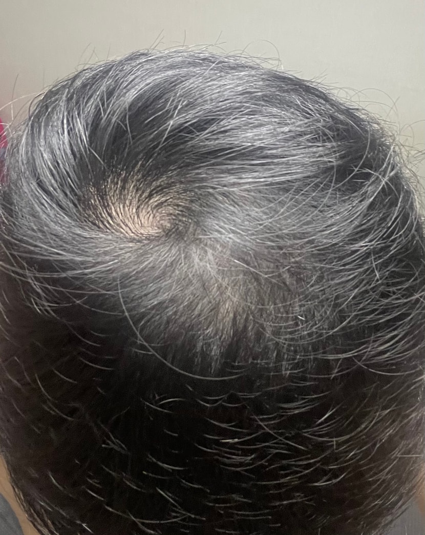 2달하고 일주일 현재