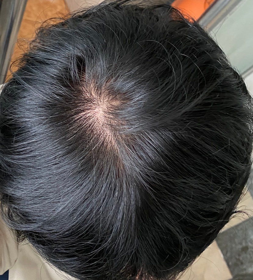 저연광 조금