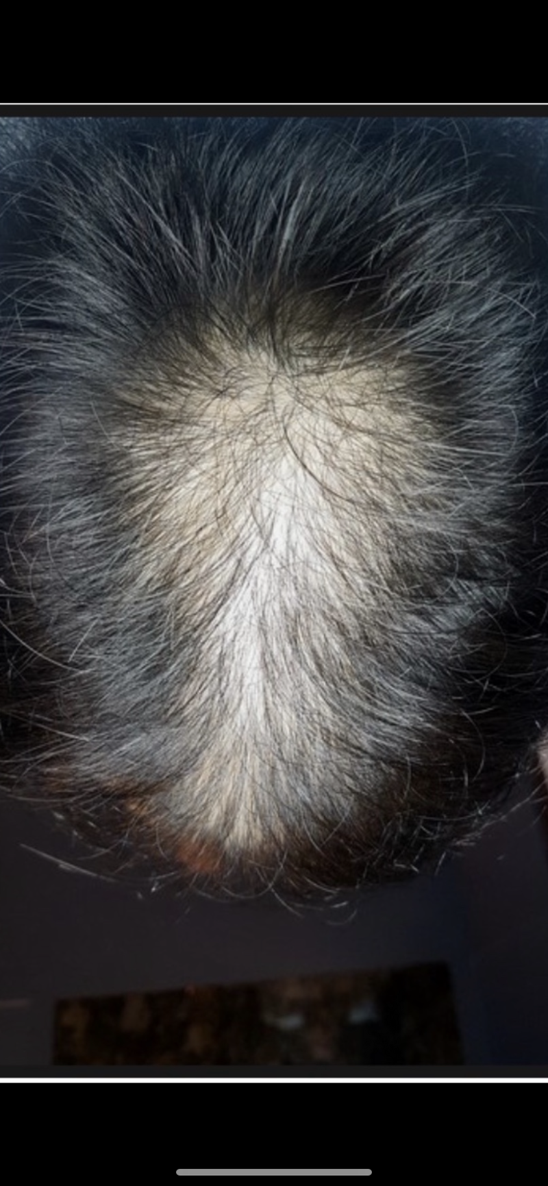 薬+未収録の20ヶ月はいかがですか？