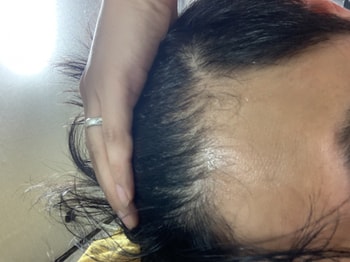 바르기전 오른쪽