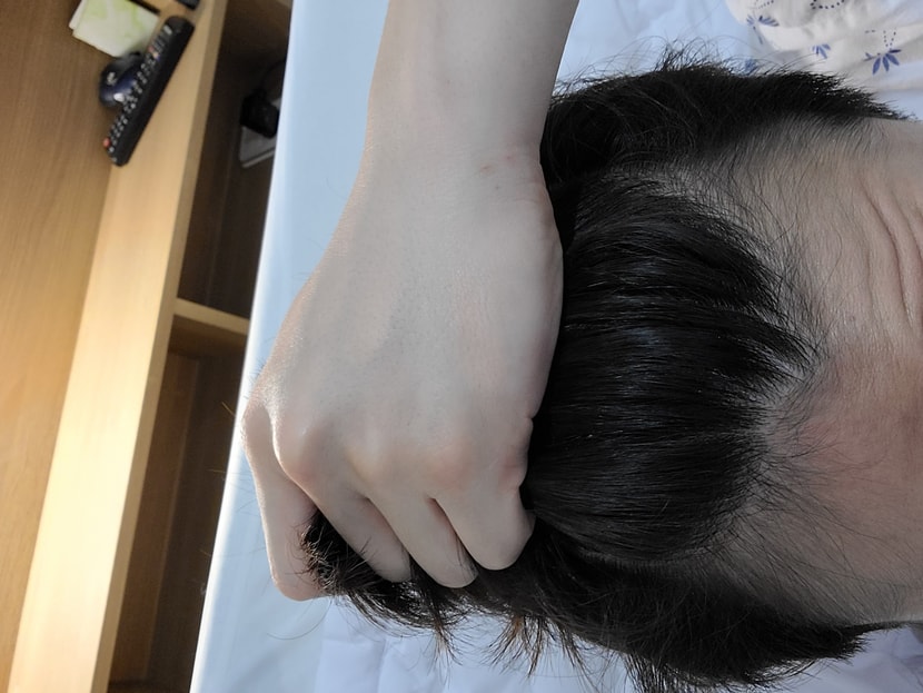 약복용 ㅣ개월차