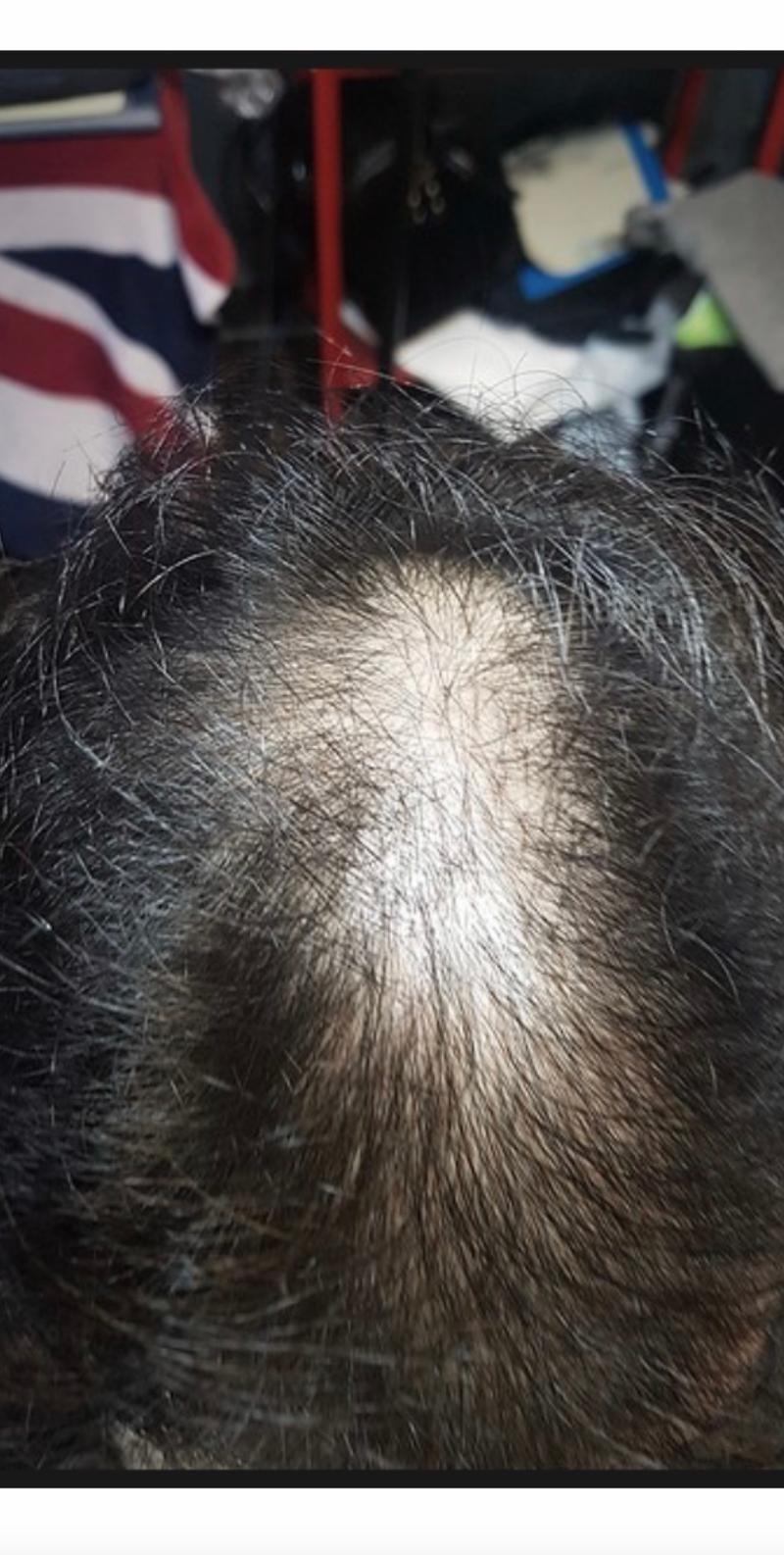 薬+未収録の17ヶ月はいかがですか？